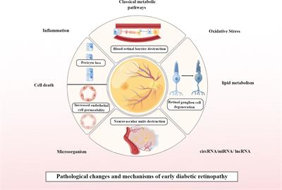 The ideal treatment timing for diabetic retinopathy: the molecular pathological mechanisms underlying early-stage diabetic retinopathy are a matter of concern